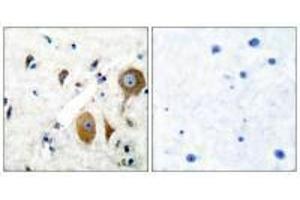 Immunohistochemical analysis of paraffin-embedded human brain tissue using GluR8 antibody. (GRM8 Antikörper)