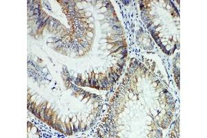 IHC-P: FER antibody testing of rat intestine tissue (FER Antikörper  (Middle Region))