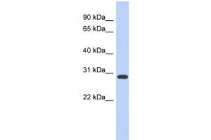 WB Suggested Anti-HOXD12 Antibody Titration:  0. (HOXD12 Antikörper  (Middle Region))