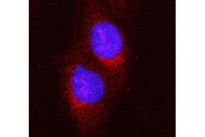 IF analysis of HERC5 using anti-HERC5 antibody (ABIN6719405). (HERC5 Antikörper  (AA 793-1024))