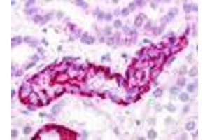 Anti-GPRC5D antibody IHC of human kidney, renal tubule. (GPRC5D Antikörper  (Extracellular Domain))