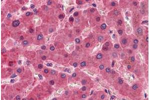 Liver, Human: Formalin-Fixed, Paraffin-Embedded (FFPE) (F12 Antikörper)