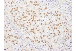 anti-Werner Helicase Interacting Protein 1 (WRNIP1) (AA 400-450) antibody