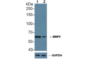Knockout Varification:,Lane 1: Wild-type Jurkat cell lysate,Lane 2: MMP9 knockout Jurkat cell lysate,Predicted MW: 79 kDa ,Observed MW: 62 kDa,Primary Ab: 2 μg/mL Rabbit Anti-Rat MMP9 Antibody,Second Ab: 0.