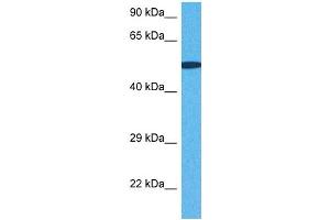 Host:  Rabbit  Target Name:  SNRNP70  Sample Tissue:  Human DLD1 Whole Cell  Antibody Dilution:  1ug/ml