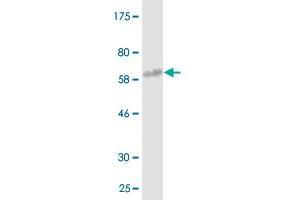 Western Blot detection against Immunogen (61.