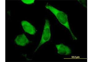 Immunofluorescence of purified MaxPab antibody to TIMM8A on HeLa cell.