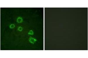 Immunofluorescence analysis of HuvEc cells, using c-PLA2 (Ab-505) Antibody. (C-PLA2 (AA 471-520) Antikörper)