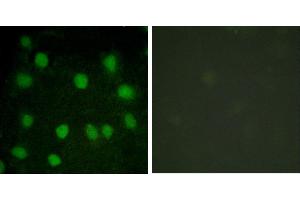 serum + -Immunofluorescence analysis of HuvEc cells, treated with serum (20%, 30mins), using Dematin (Ab-403) antibody. (Dematin Antikörper  (Ser403))