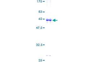 HCCS Protein (AA 1-268) (GST tag)