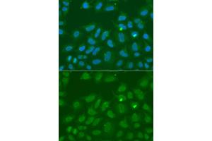 Immunofluorescence analysis of A549 cell using ORC6 antibody. (ORC6 Antikörper)
