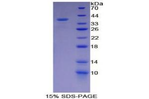 SDS-PAGE (SDS) image for Calpain 1 (CAPN1) (AA 387-694) protein (His tag) (ABIN1169979)