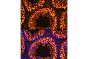 Immunofluorescence analysis of Mouse testis cells using PIWIL1 antibody (ABIN3023049, ABIN3023050, ABIN3023051 and ABIN6219364) at dilution of 1:100. (PIWIL1 Antikörper)