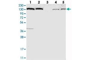 Western blot analysis of Lane 1: RT-4, Lane 2: U-251 MG, Lane 3: Human Plasma, Lane 4: Liver, Lane 5: Tonsil with PFAS polyclonal antibody  at 1:250-1:500 dilution. (PFAS Antikörper)