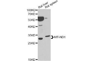 Western blot analysis of extracts of various cell lines, using MT-ND1 antibody (ABIN5973029) at 1/1000 dilution. (MT-ND1 Antikörper)