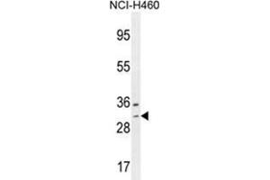 WBSCR27 Antibody (N-term) western blot analysis in NCI-H460 cell line lysates (35 µg/lane).