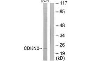 Western blot analysis of extracts from LOVO cells, using CDKN3 Antibody.