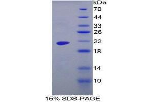 SDS-PAGE (SDS) image for Maltase-Glucoamylase (MGAM) (AA 213-392) protein (His tag) (ABIN1080246) (Maltase-Glucoamylase (MGAM) (AA 213-392) protein (His tag))