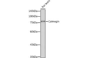Western blot analysis of extracts of Rat testis, using Calmegin Rabbit mAb (ABIN7266025) at 1:1000 dilution. (Calmegin Antikörper)