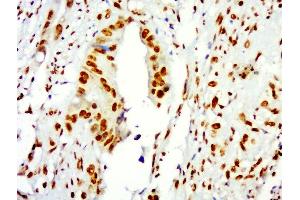Immunohistochemistry (Paraffin-embedded Sections) (IHC (p)) image for anti-Histone 3 (H3) (AA 71-136) antibody (ABIN739109)