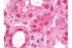 Immunohistochemistry (IHC) image for anti-Transcription Factor 7-Like 2 (T-Cell Specific, HMG-Box) (TCF7L2) (N-Term) antibody (ABIN959387)