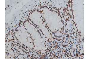 ABIN6267568 at 1/200 staining human colon tissue sections by IHC-P.