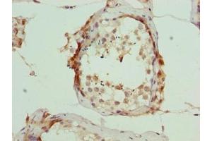 Immunohistochemistry of paraffin-embedded human testis tissue using ABIN7166405 at dilution of 1:100 (ARMT1 (AA 2-250) Antikörper)