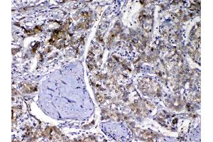 IHC analysis of Vitamin D Binding protein using anti-Vitamin D Binding protein antibody . (Gc (AA 17-256) Antikörper)