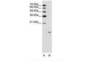 Image no. 1 for anti-Glucagon (GCG) (AA 41-90) antibody (ABIN203495) (Glucagon Antikörper  (AA 41-90))