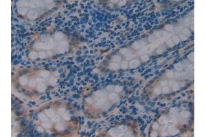 DAB staining on IHC-P; Samples: Human Rectum Tissue (PDK1 Antikörper  (AA 233-430))