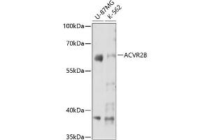 Western blot analysis of extracts of various cell lines, using B antibody (ABIN7265414) at 1:3000 dilution. (ACVR2B Antikörper  (AA 50-150))