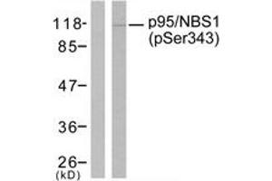 Western blot analysis of extracts from Jurkat cells, using p95/NBS1 (Phospho-Ser343) Antibody. (Nibrin Antikörper  (pSer343))