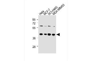 All lanes : Anti-LTM4B-4 Antibody at 1:250 dilution Lane 1: Hela whole cell lysates Lane 2: MCF-7 whole cell lysates Lane 3: NCI- whole cell lysates Lane 4: MDA-M whole cell lysates Lysates/proteins at 20 μg per lane. (LAPTM4B Antikörper  (AA 195-209))