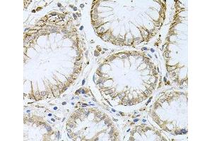 Immunohistochemistry (Paraffin-embedded Sections) (IHC (p)) image for anti-Hermansky-Pudlak Syndrome 1 (HPS1) antibody (ABIN7262497)