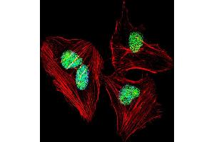 Fluorescent confocal image of Hela cell stained with NFIA Antibody . (NFIA Antikörper  (C-Term))