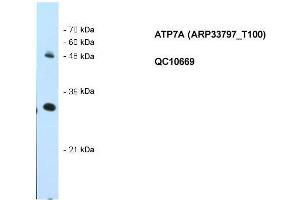 WB Suggested Anti-ATP7A Antibody Titration: 0. (ATP7A Antikörper  (N-Term))