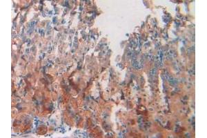 Immunohistochemistry (IHC) image for anti-Resistin (RETN) (AA 21-114) antibody (ABIN7427927)