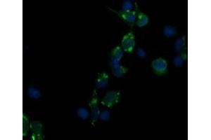 Image no. 4 for anti-CD3 epsilon (CD3E) antibody (ABIN1497222)
