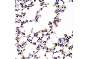 Immunohistochemistry of paraffin-embedded Mouse lung using CMPK1 antibody at dilution of 1:100 (x400 lens). (Cytidine Monophosphate (UMP-CMP) Kinase 1, Cytosolic (CMPK1) Antikörper)