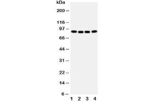 Western blot testing of CUL2 antibody and human samples 1:  A431;  2: SMMC-7721;  3: HeLa;  4: COLO320 cell lysate. (Cullin 2 Antikörper  (Middle Region))