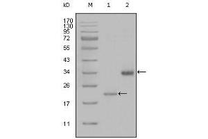 Western Blot showing LPA antibody used against truncated LPA-His recombinant protein (1) and truncated Trx-LPA (aa4330-4521) recombinant protein (2).