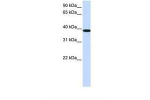 KLHDC8B anticorps  (AA 218-267)