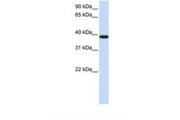 KLHDC8B Antikörper  (AA 218-267)