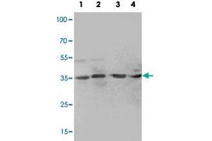Western blot analysis of tissue lysates with MTA1 polyclonal antibody . (MTA1 Antikörper  (C-Term))
