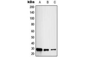 Western blot analysis of RAB20 expression in HL60 (A), HeLa (B), HuvEc (C) whole cell lysates. (RAB20 Antikörper  (Center))