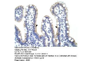 Rabbit Anti-EXOSC10 Antibody  Paraffin Embedded Tissue: Human Intestine Cellular Data: Epithelial cells of intestinal villas Antibody Concentration: 4. (EXOSC10 Antikörper  (C-Term))