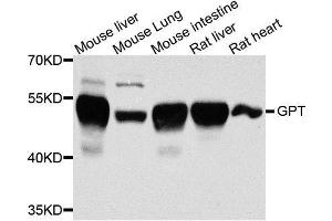 Western blot analysis of extracts of various cell lines, using GPT antibody. (ALT Antikörper  (AA 1-190))