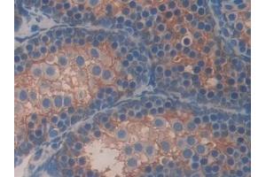 Immunohistochemistry (IHC) image for anti-serpin Peptidase Inhibitor, Clade A (Alpha-1 Antiproteinase, Antitrypsin), Member 6 (SERPINA6) (AA 268-391) antibody (ABIN7438403)