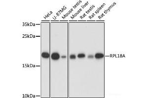 Western blot analysis of extracts of various cell lines using RPL18A Polyclonal Antibody at dilution of 1:1000. (RPL18A Antikörper)