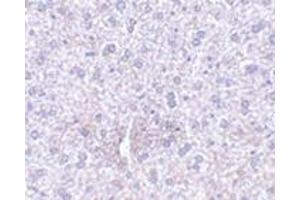 Immunohistochemistry of TEM7 in mouse liver tissue with this product at 2. (PLXDC1 Antikörper  (Center))
